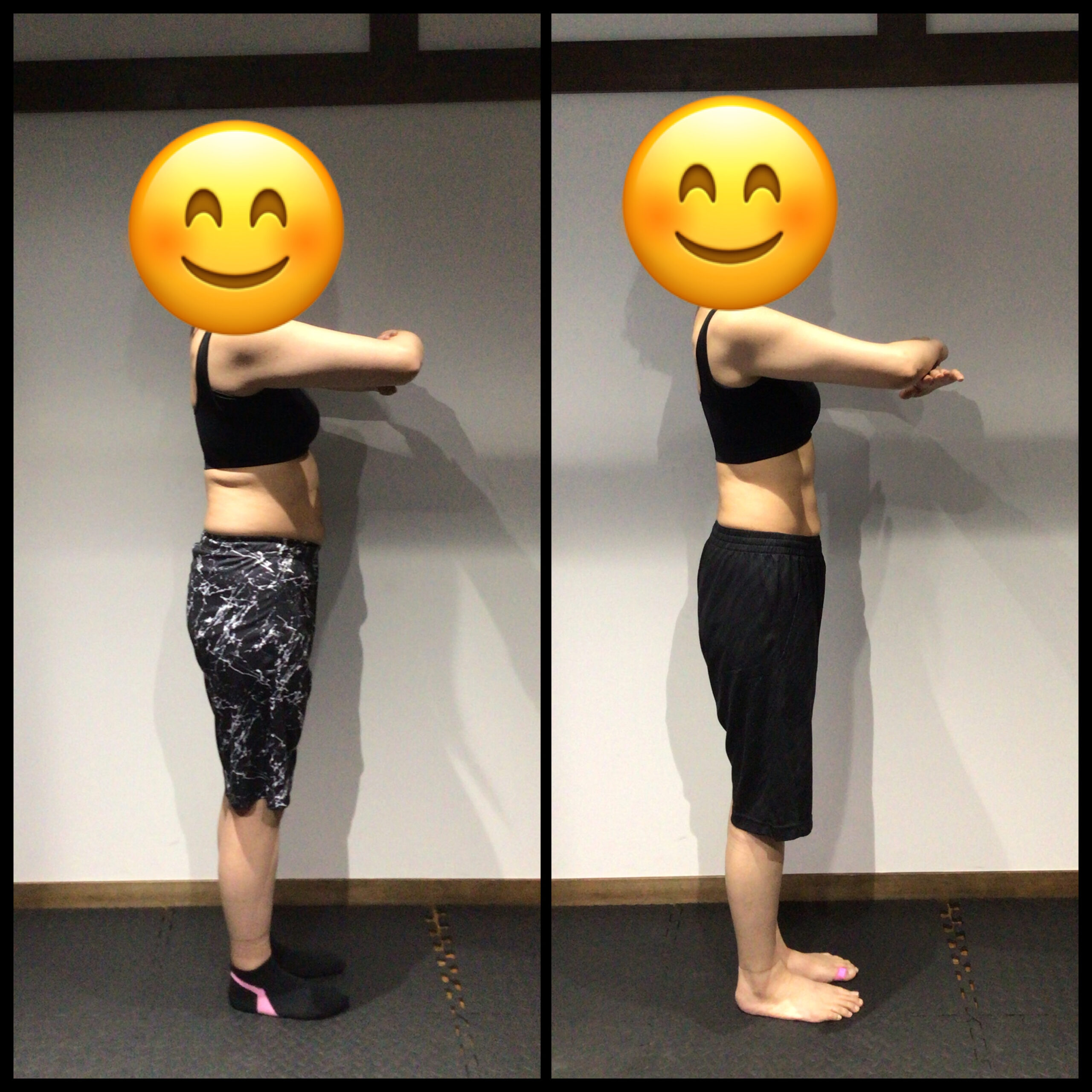 T.S様のビフォーアフター