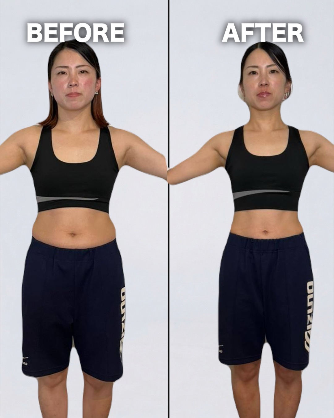 30代女性 Before/After 変化画像