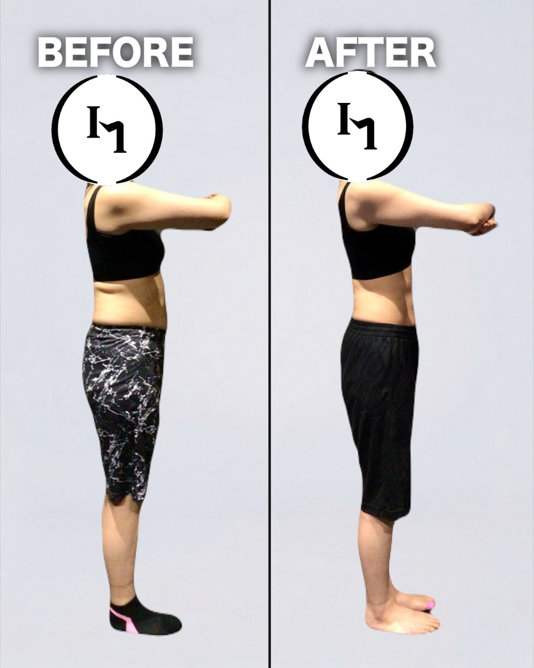 50代女性 Before/After 変化画像
