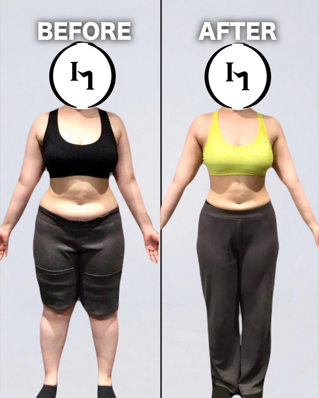 30代女性 Before / After 写真
