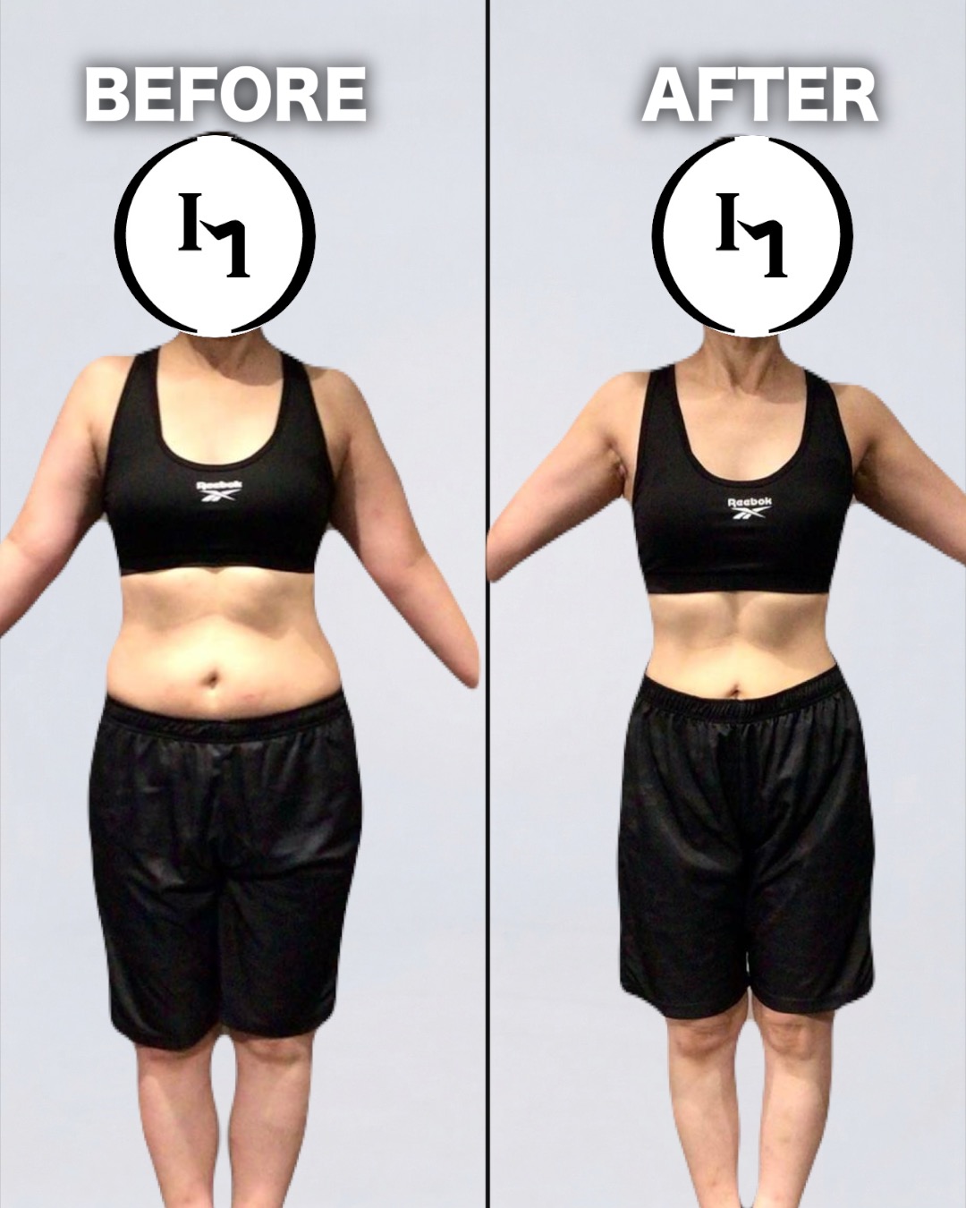 50代女性 Before / After 写真